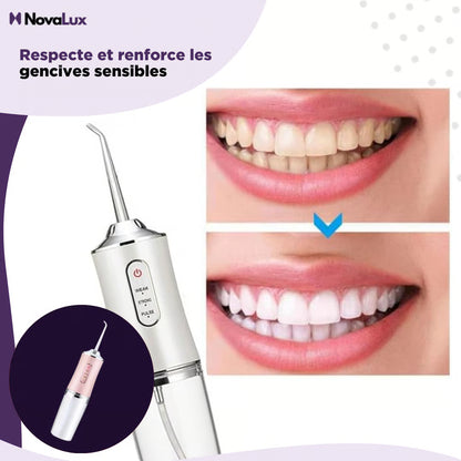 Hydropulseur Jet dentaire portable
